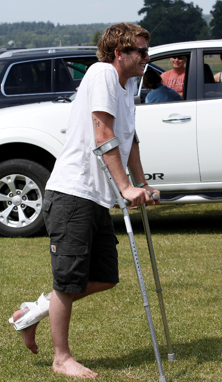 Social-Charlie Hanbury injured